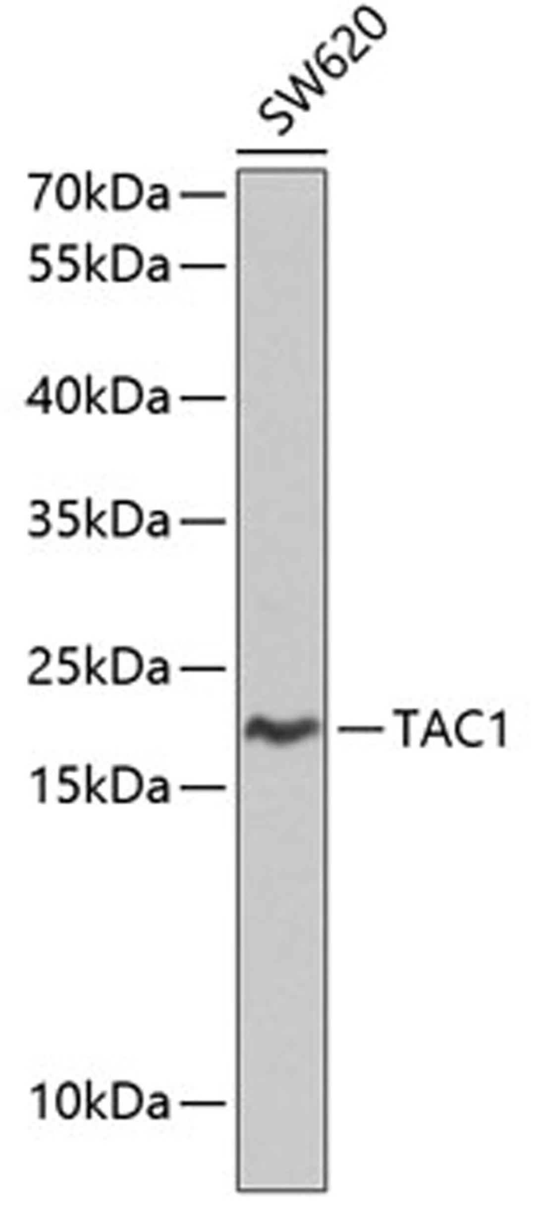 Western blot - TAC1 antibody (A1666)