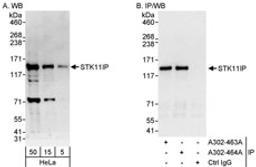 Detection of human STK11IP by western blot and immunoprecipitation.