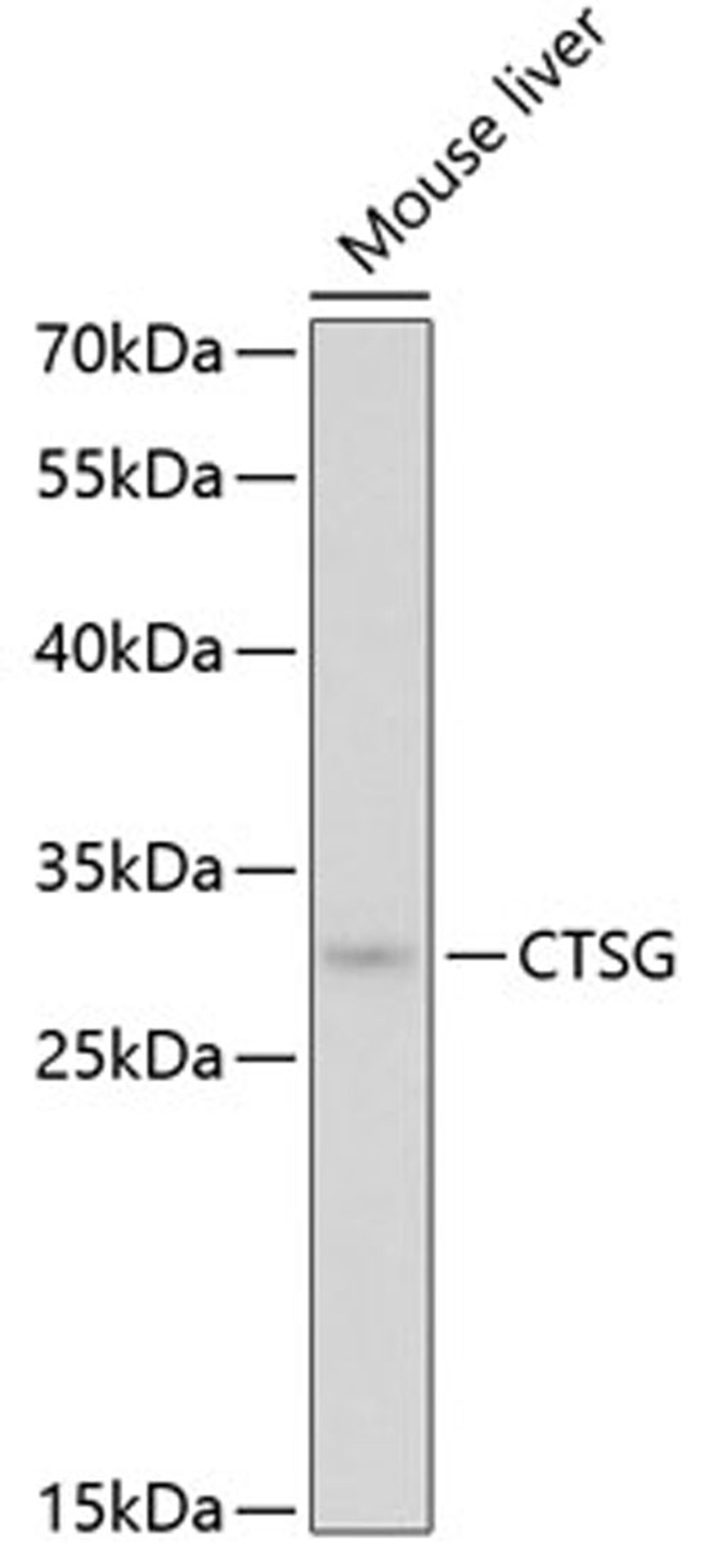 Western blot - CTSG antibody (A5636)