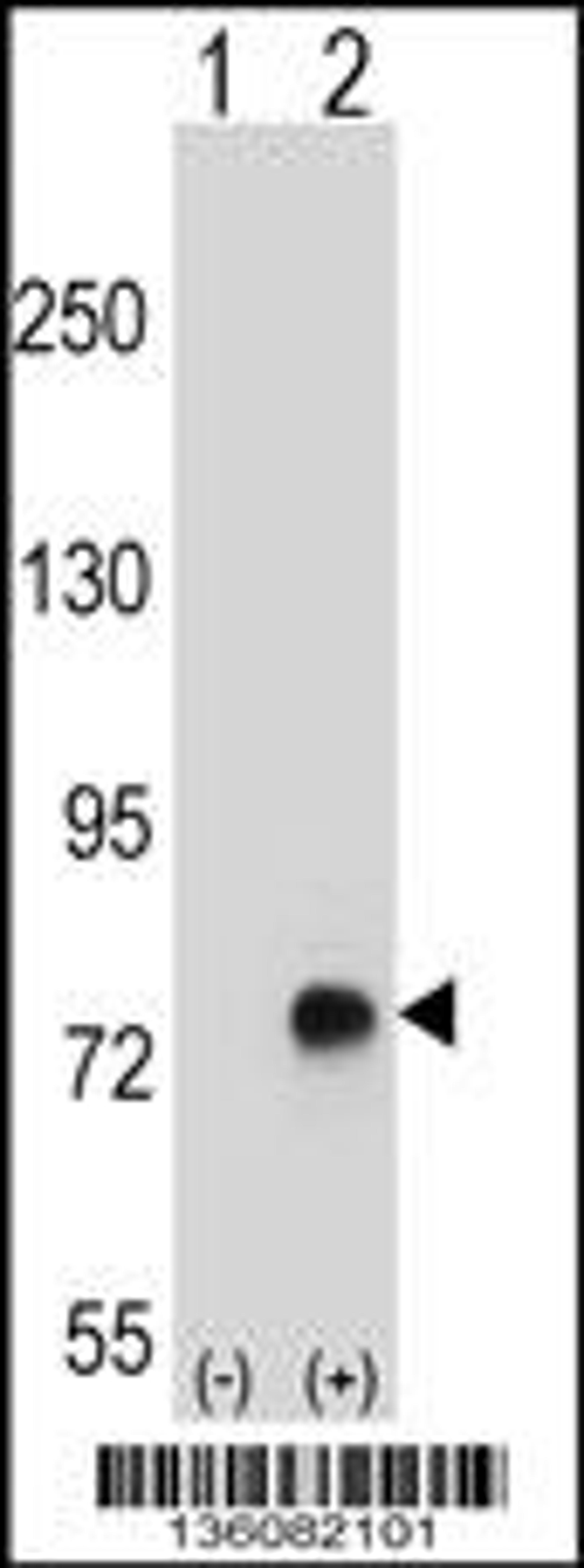 Western blot analysis of TGFBI using rabbit polyclonal TGFBI Antibody using 293 cell lysates (2 ug/lane) either nontransfected (Lane 1) or transiently transfected (Lane 2) with the TGFBI gene.