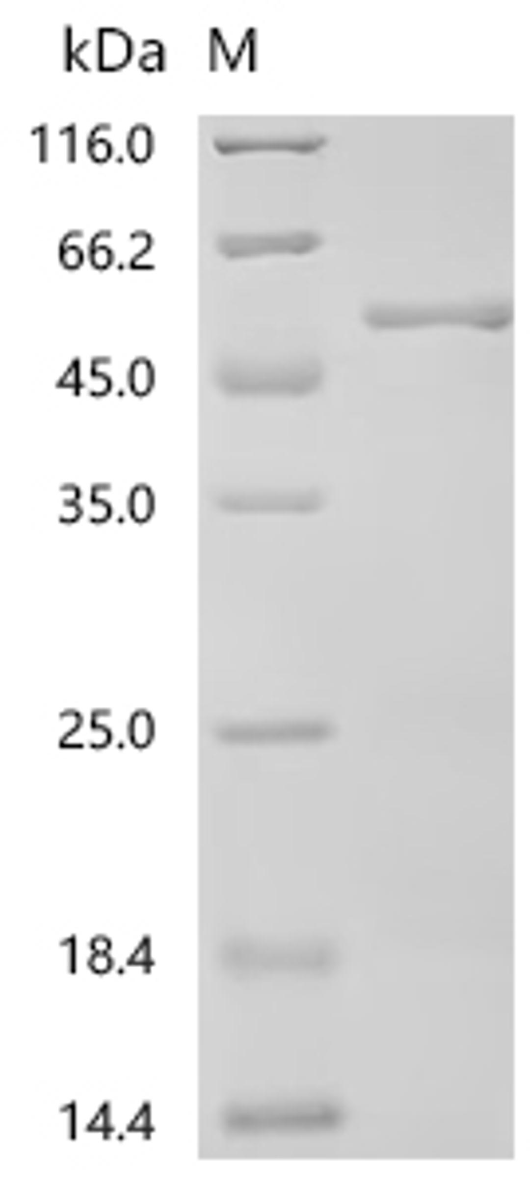 (Tris-Glycine gel) Discontinuous SDS-PAGE (reduced) with 5% enrichment gel and 15% separation gel.