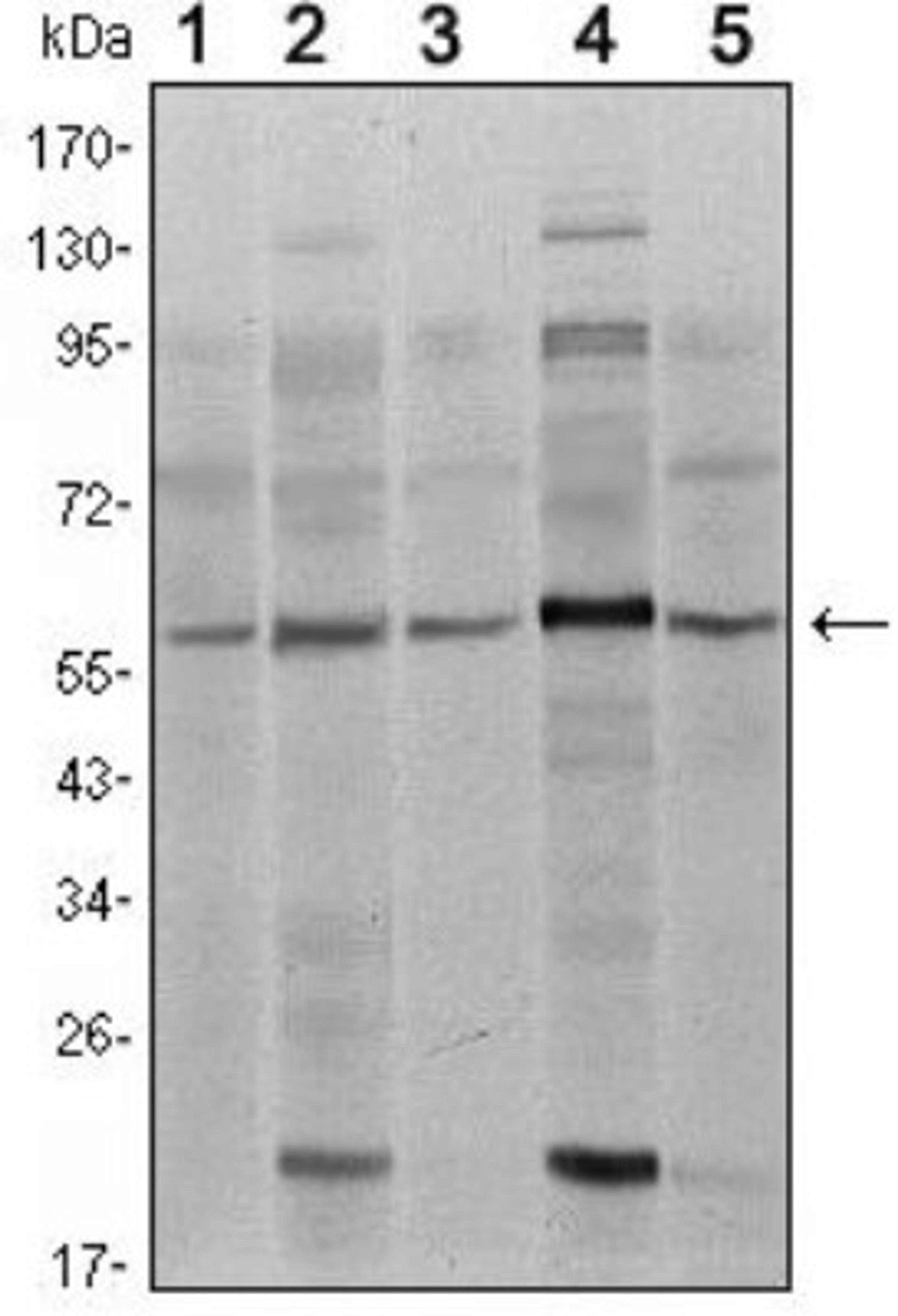 Western Blot: Smad4 Antibody (4G1C6) [NBP1-51646] - Analysis using SMAD4 mouse mAb against A431 (1), SK-N-SH (2), K562 (3), HepG2 (4) and HUVE12 (5) cell lysate.