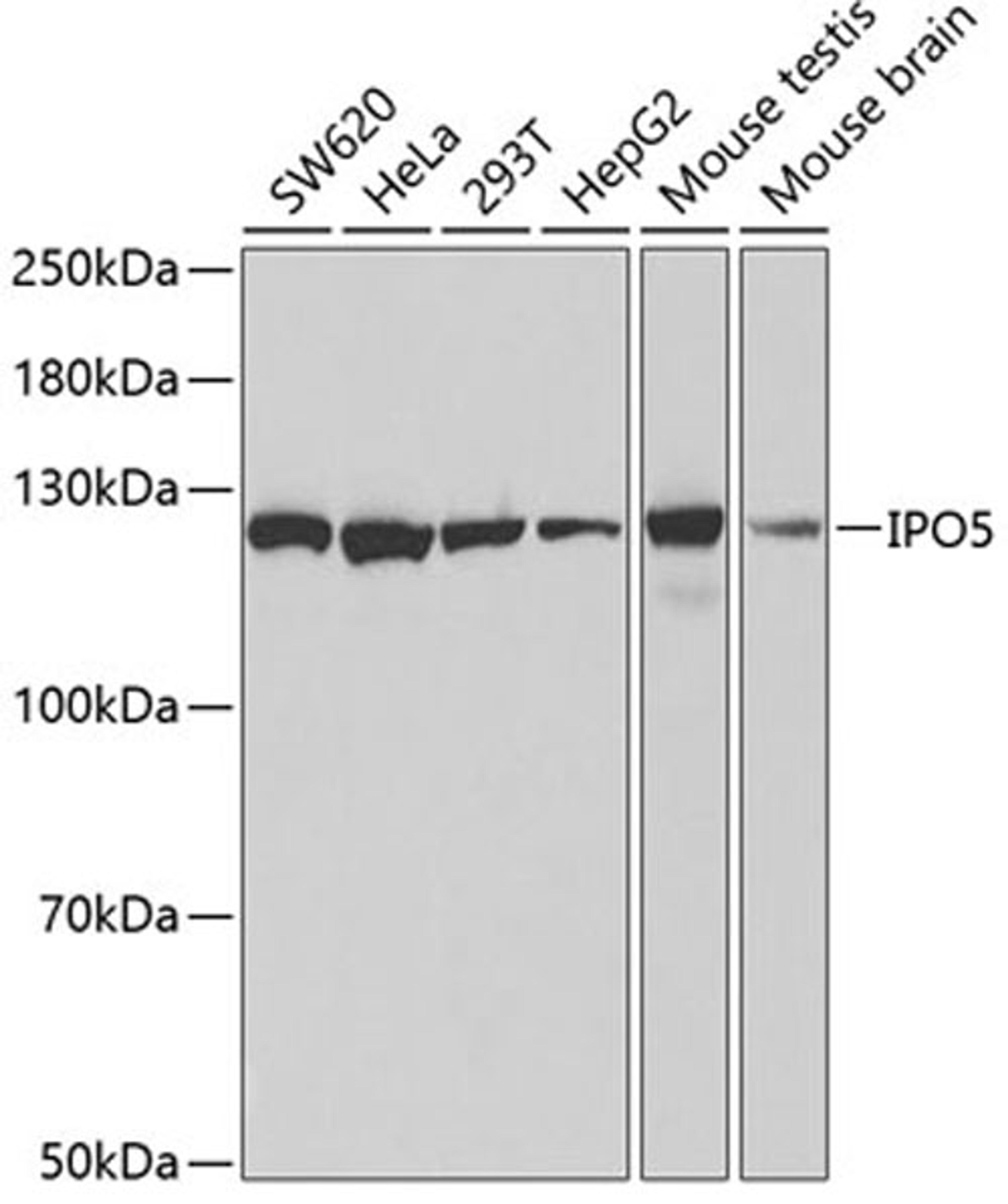 Western blot - IPO5 antibody (A1984)