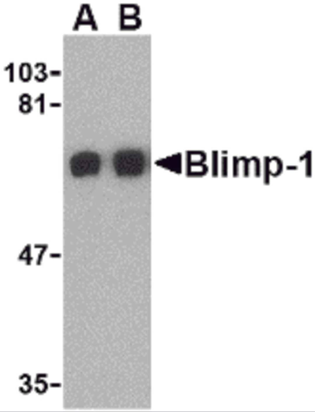 Western blot analysis of Blimp-1 in A549 cell lysate with Blimp-1 antibody at (A) 0.5 and (B) 1μg/mL.