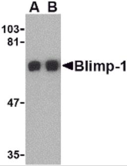 Western blot analysis of Blimp-1 in A549 cell lysate with Blimp-1 antibody at (A) 0.5 and (B) 1μg/mL.