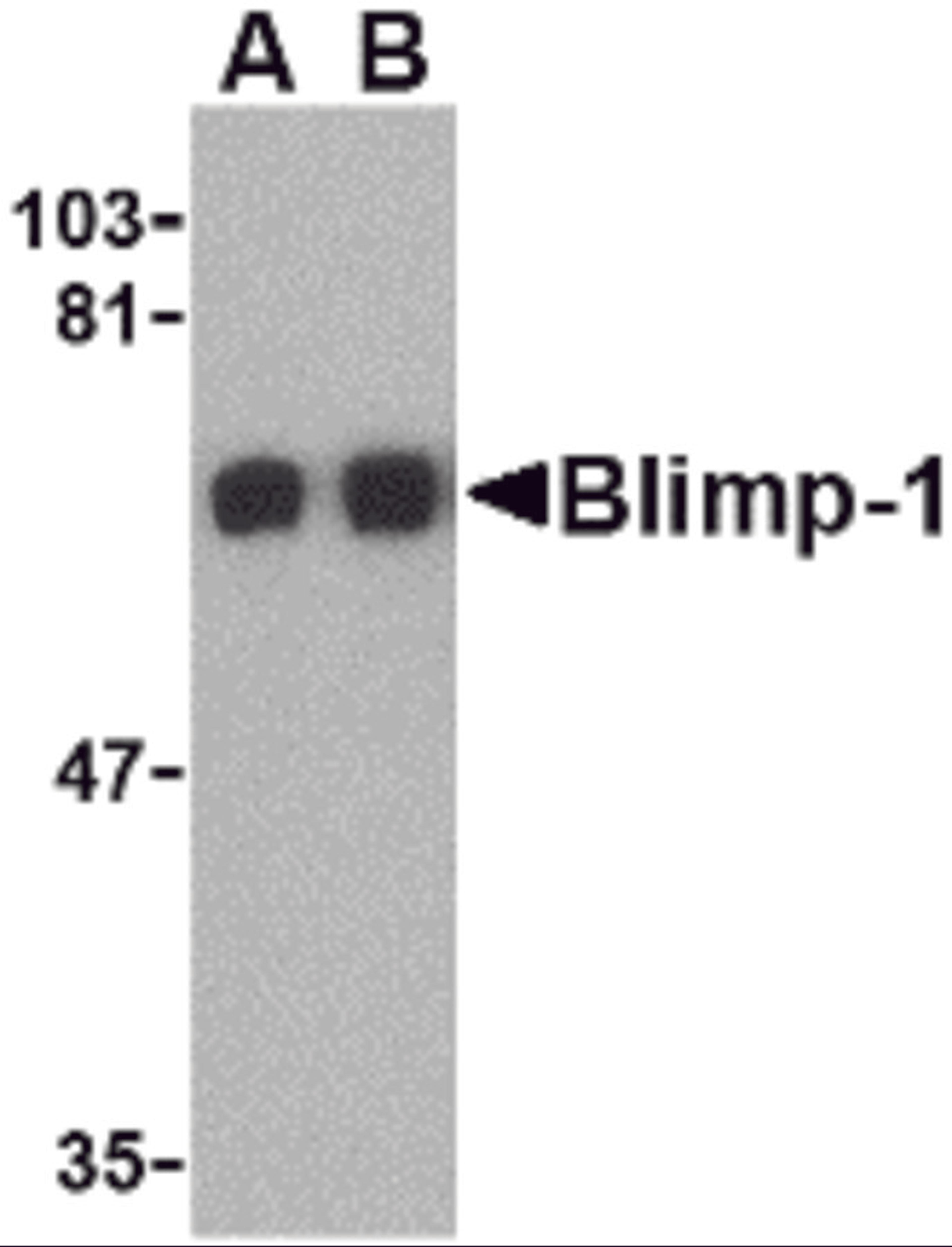 Western blot analysis of Blimp-1 in A549 cell lysate with Blimp-1 antibody at (A) 0.5 and (B) 1μg/mL.