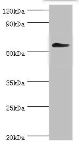 Western blot. All lanes: T-complex protein 1 subunit gamma antibody at 12ug/ml + Mouse brain tissue. Secondary. Goat polyclonal to rabbit IgG at 1/10000 dilution. Predicted band size: 61, 57 kDa. Observed band size: 61 kDa.