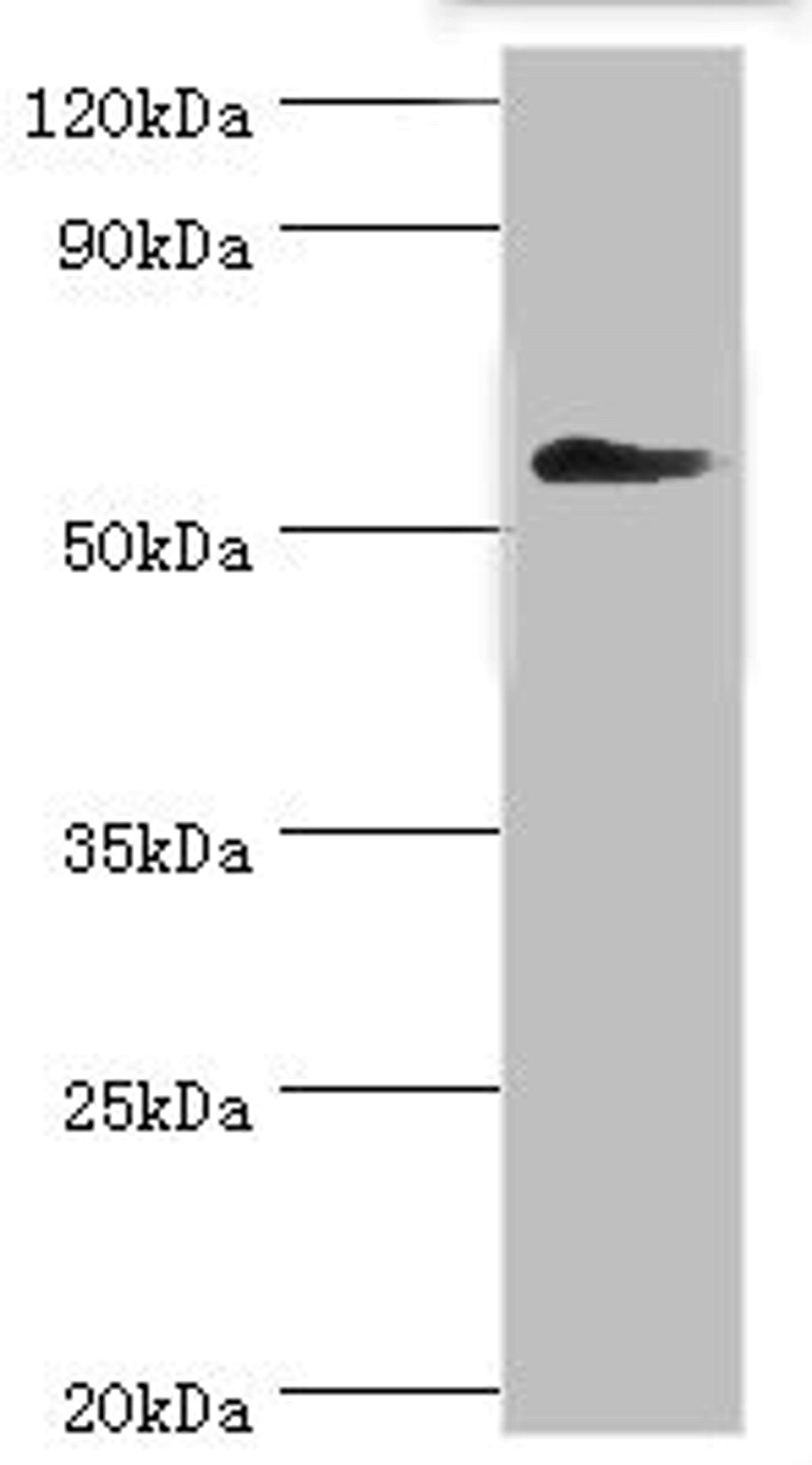 Western blot. All lanes: T-complex protein 1 subunit gamma antibody at 12ug/ml + Mouse brain tissue. Secondary. Goat polyclonal to rabbit IgG at 1/10000 dilution. Predicted band size: 61, 57 kDa. Observed band size: 61 kDa.