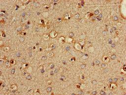 Immunohistochemistry of paraffin-embedded human brain tissue using CSB-PA018146LA01HU at dilution of 1:100