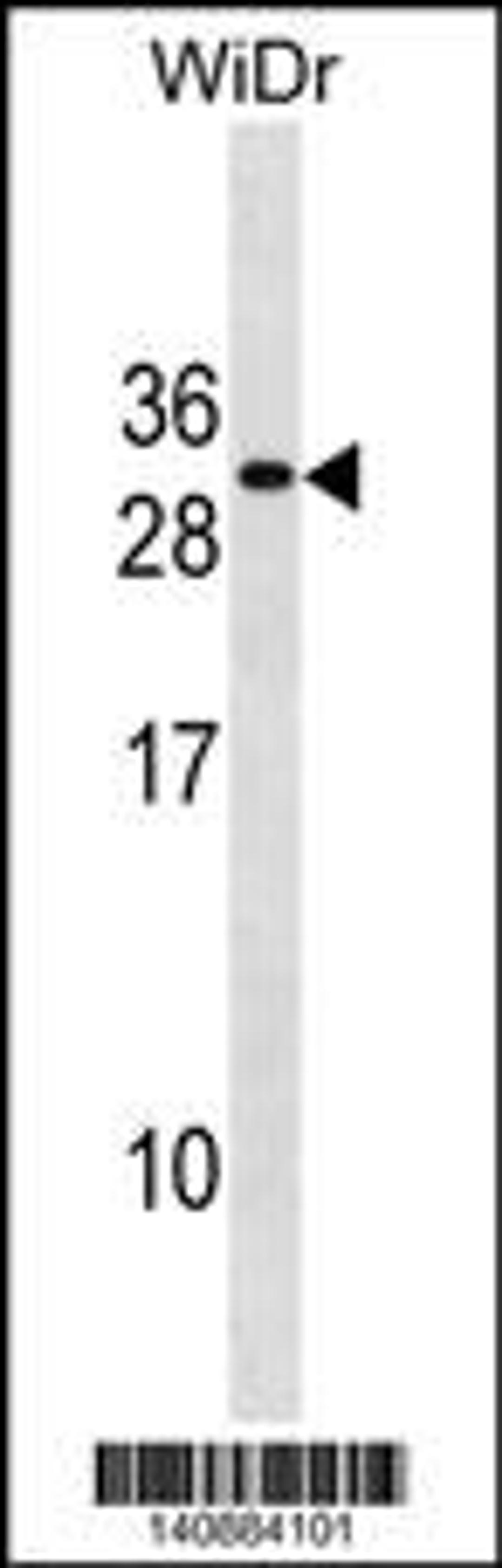 Western blot analysis in WiDr cell line lysates (35ug/lane).