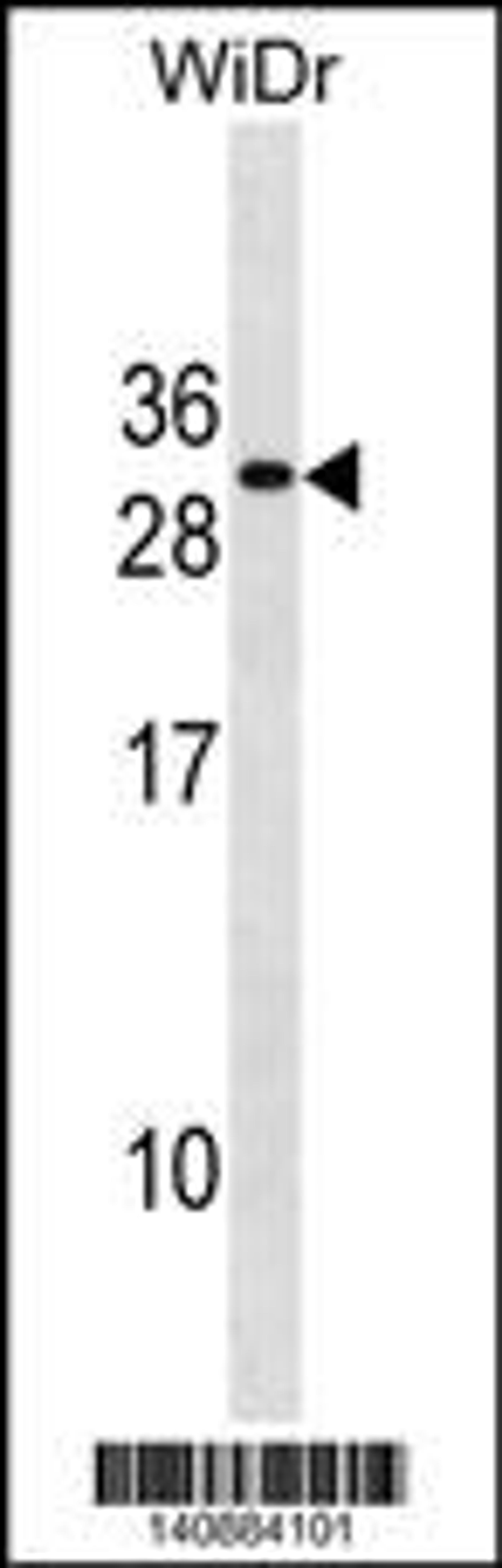 Western blot analysis in WiDr cell line lysates (35ug/lane).