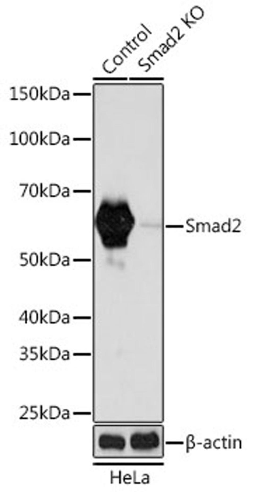 Western blot - Smad2 antibody (A19114)