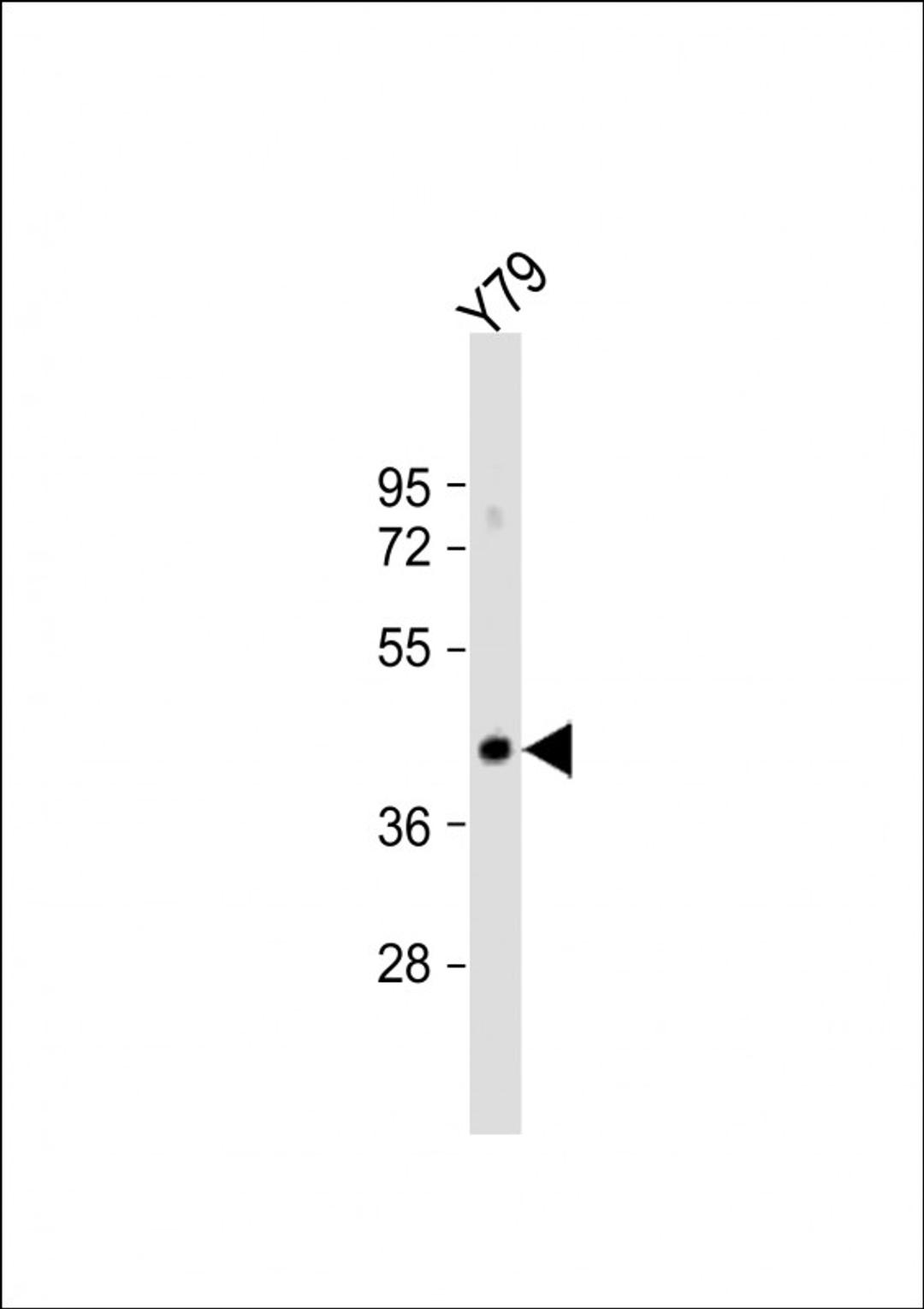 Western Blot at 1:1000 dilution + Y79 whole cell lysate Lysates/proteins at 20 ug per lane.