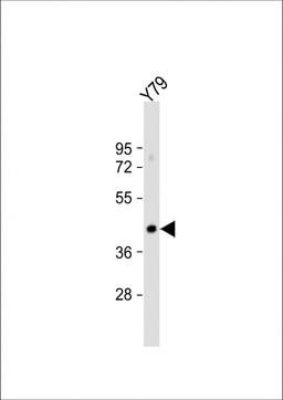 Western Blot at 1:1000 dilution + Y79 whole cell lysate Lysates/proteins at 20 ug per lane.