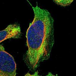 Immunocytochemistry/Immunofluorescence: PPP1R16A Antibody [NBP1-82750] - Staining of human cell line U-2 OS shows positivity in plasma membrane.