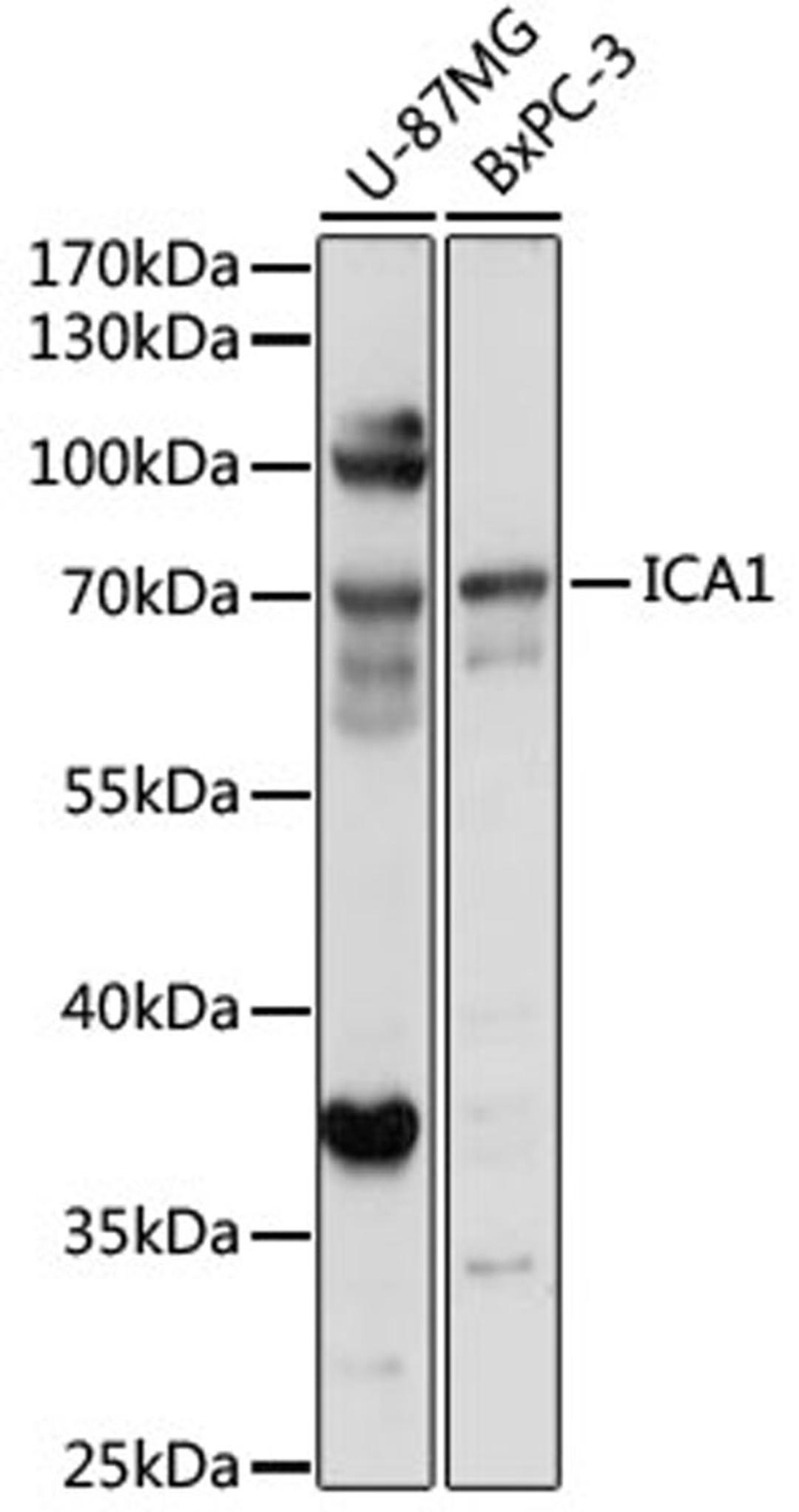 Western blot - ICA1 antibody (A17500)