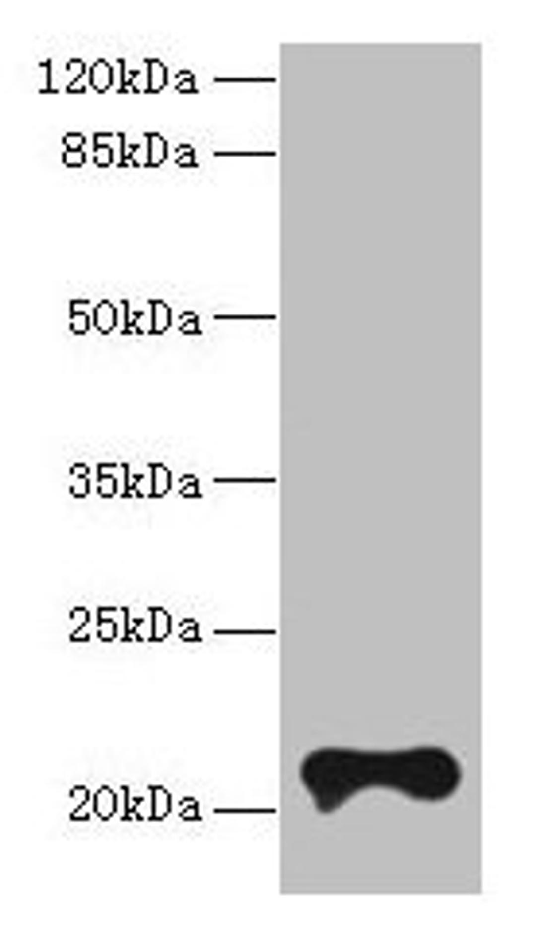 Western blot. All lanes: TMEM154 antibody at 6µg/ml + MCF-7 whole cell lysate. Secondary. Goat polyclonal to rabbit IgG at 1/10000 dilution. Predicted band size: 21 kDa. Observed band size: 21 kDa