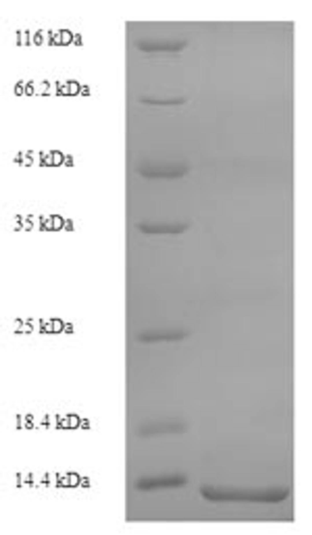 (Tris-Glycine gel) Discontinuous SDS-PAGE (reduced) with 5% enrichment gel and 15% separation gel.