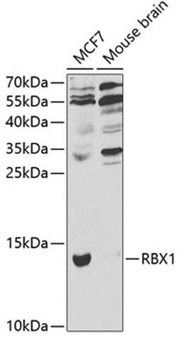 Western blot - RBX1 antibody (A1832)