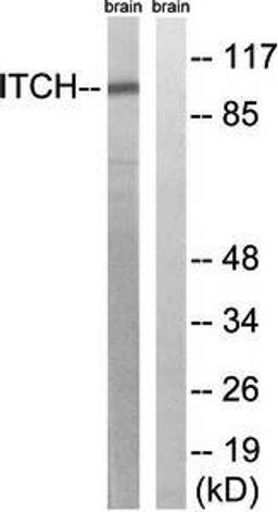 Western blot analysis of extracts from mouse brain cells using ITCH antibody