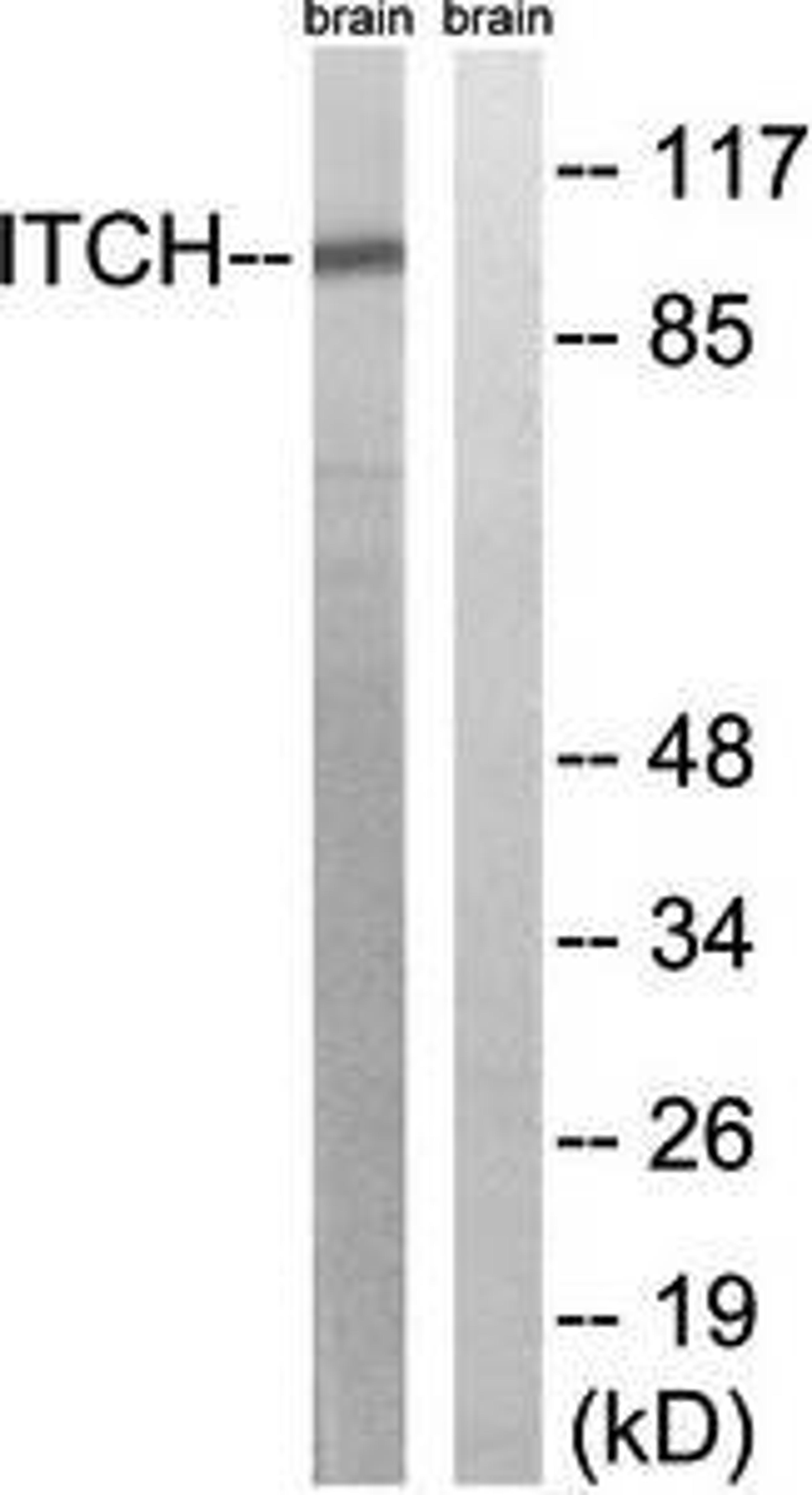 Western blot analysis of extracts from mouse brain cells using ITCH antibody