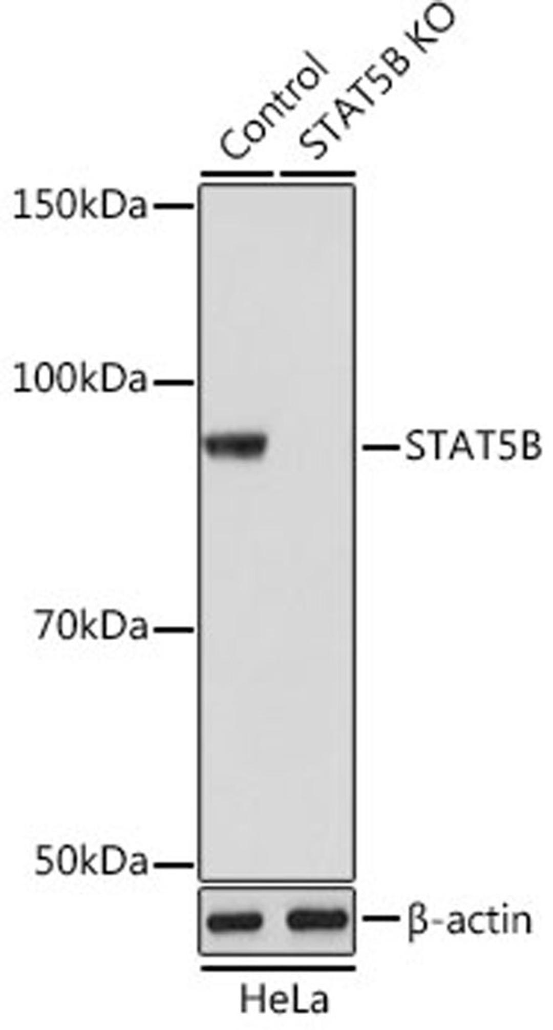 Western blot - STAT5B antibody (A19567)