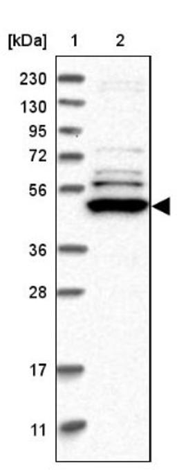 Western Blot: TRMT61B Antibody [NBP1-83640] - Lane 1: Marker [kDa] 230, 130, 95, 72, 56, 36, 28, 17, 11<br/>Lane 2: Human cell line RT-4