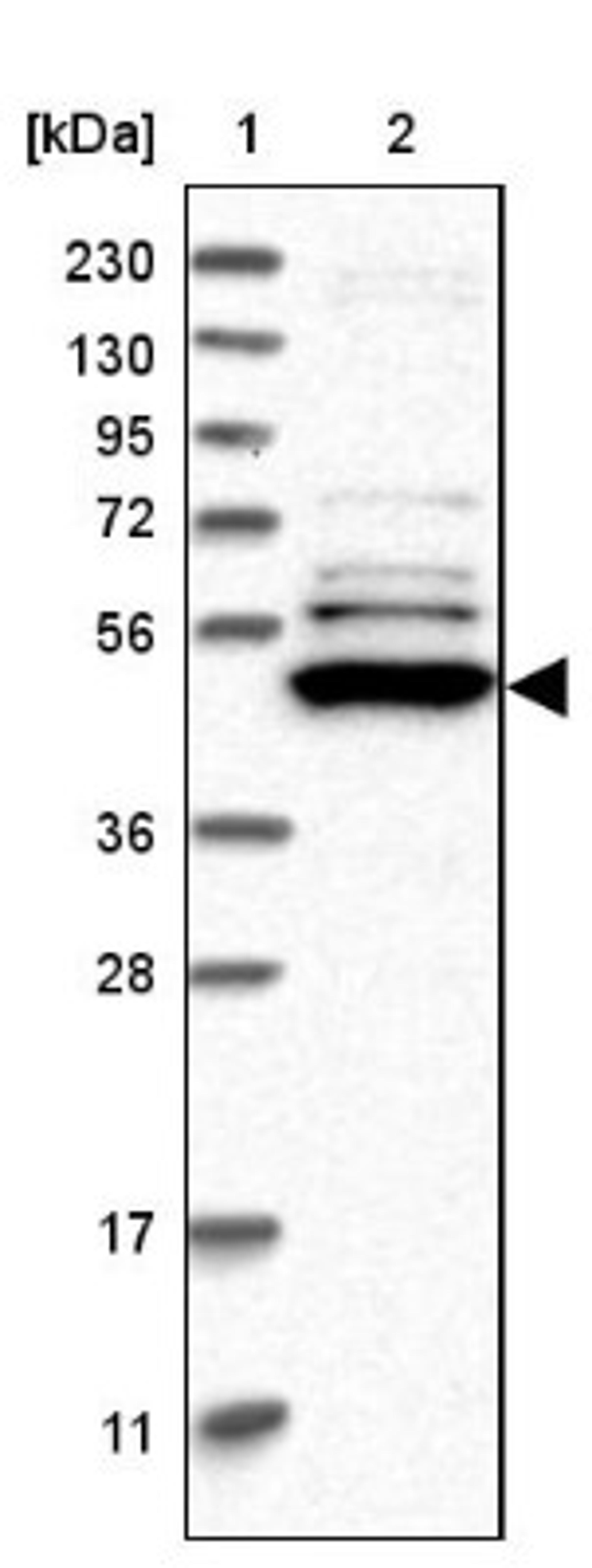 Western Blot: TRMT61B Antibody [NBP1-83640] - Lane 1: Marker [kDa] 230, 130, 95, 72, 56, 36, 28, 17, 11<br/>Lane 2: Human cell line RT-4