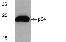 Western blot analysis of 20 ng of recombinant HIV-1 p24 protein with PM-6335-HRP at 0.2 &#956;g/mL.