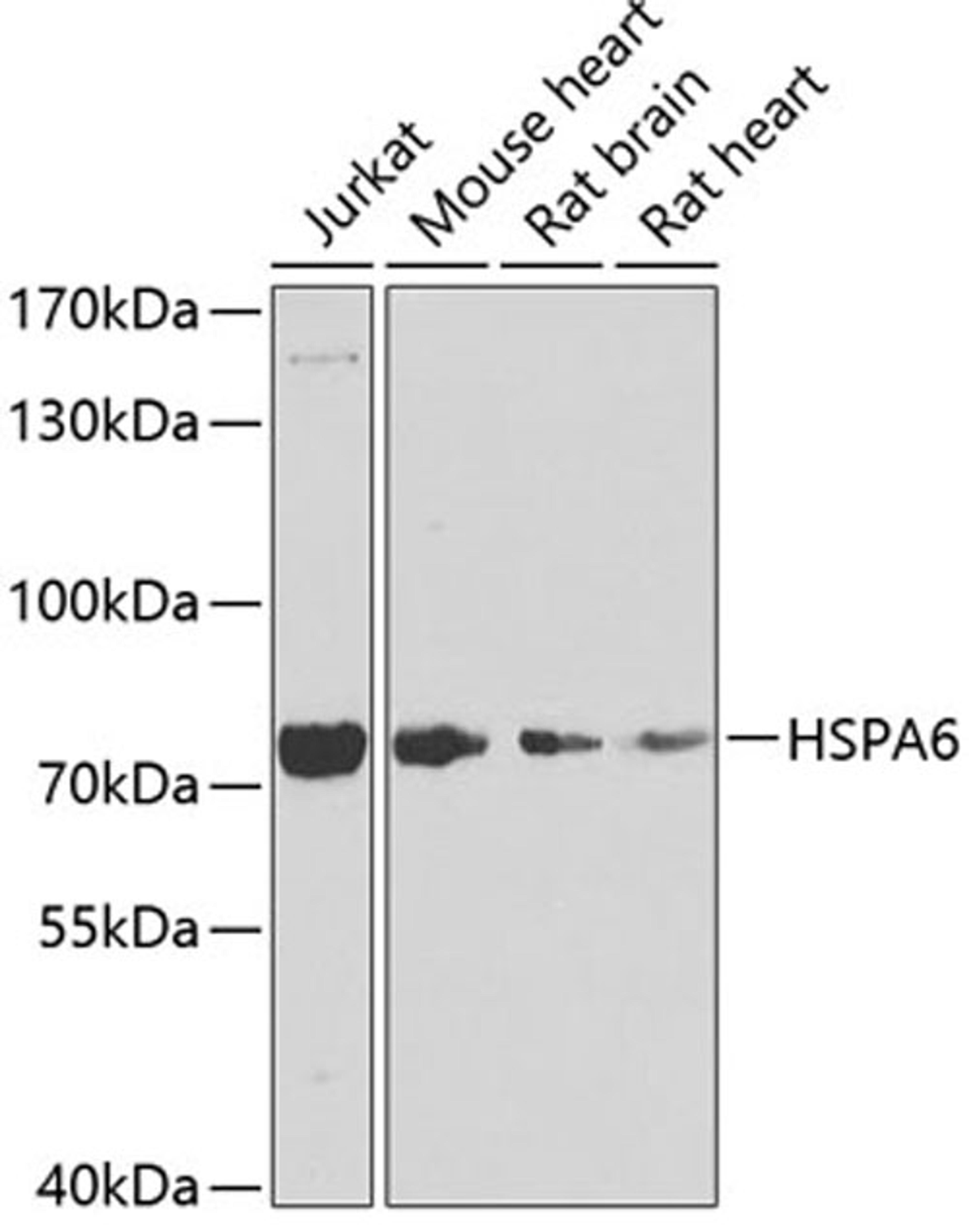 Western blot - HSPA6 antibody (A7688)