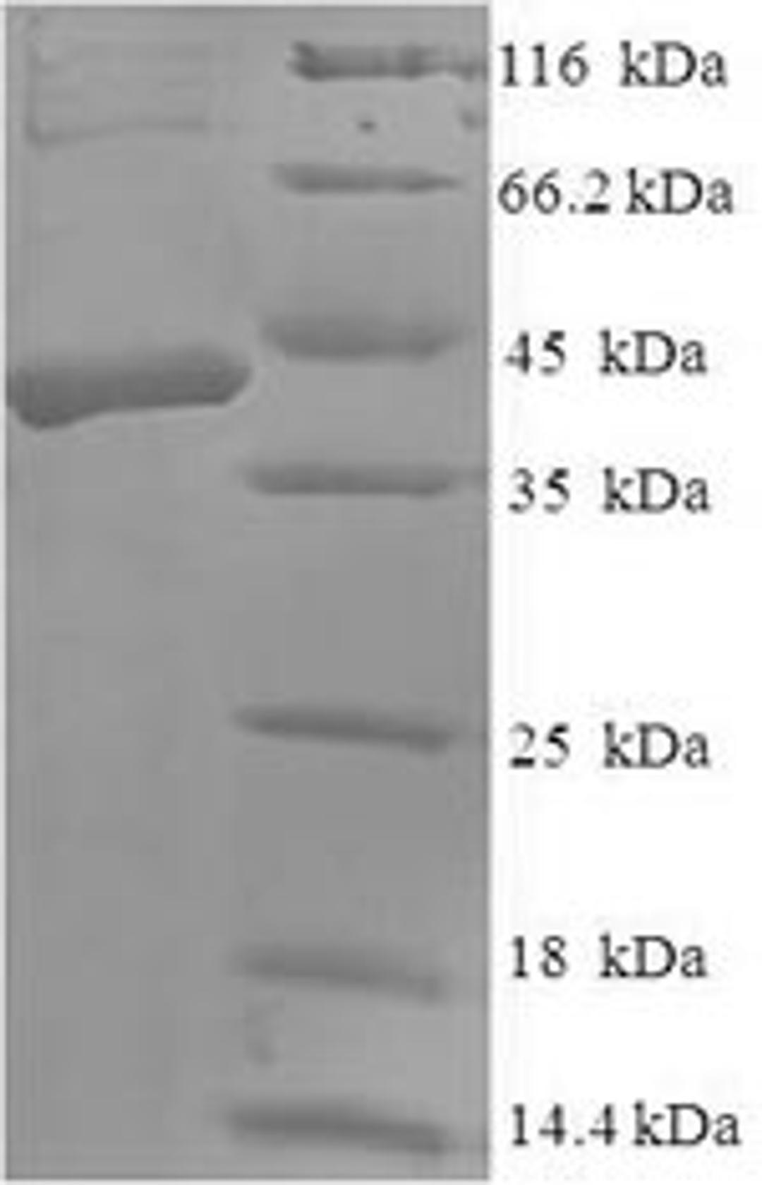 (Tris-Glycine gel) Discontinuous SDS-PAGE (reduced) with 5% enrichment gel and 15% separation gel.