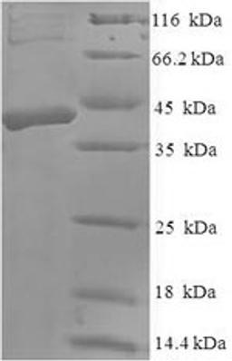(Tris-Glycine gel) Discontinuous SDS-PAGE (reduced) with 5% enrichment gel and 15% separation gel.