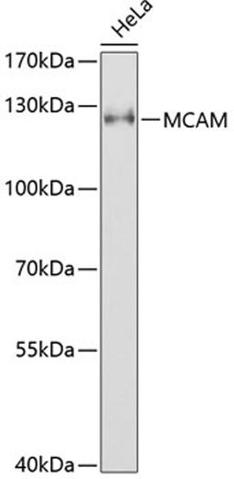 Western blot - MCAM antibody (A1962)