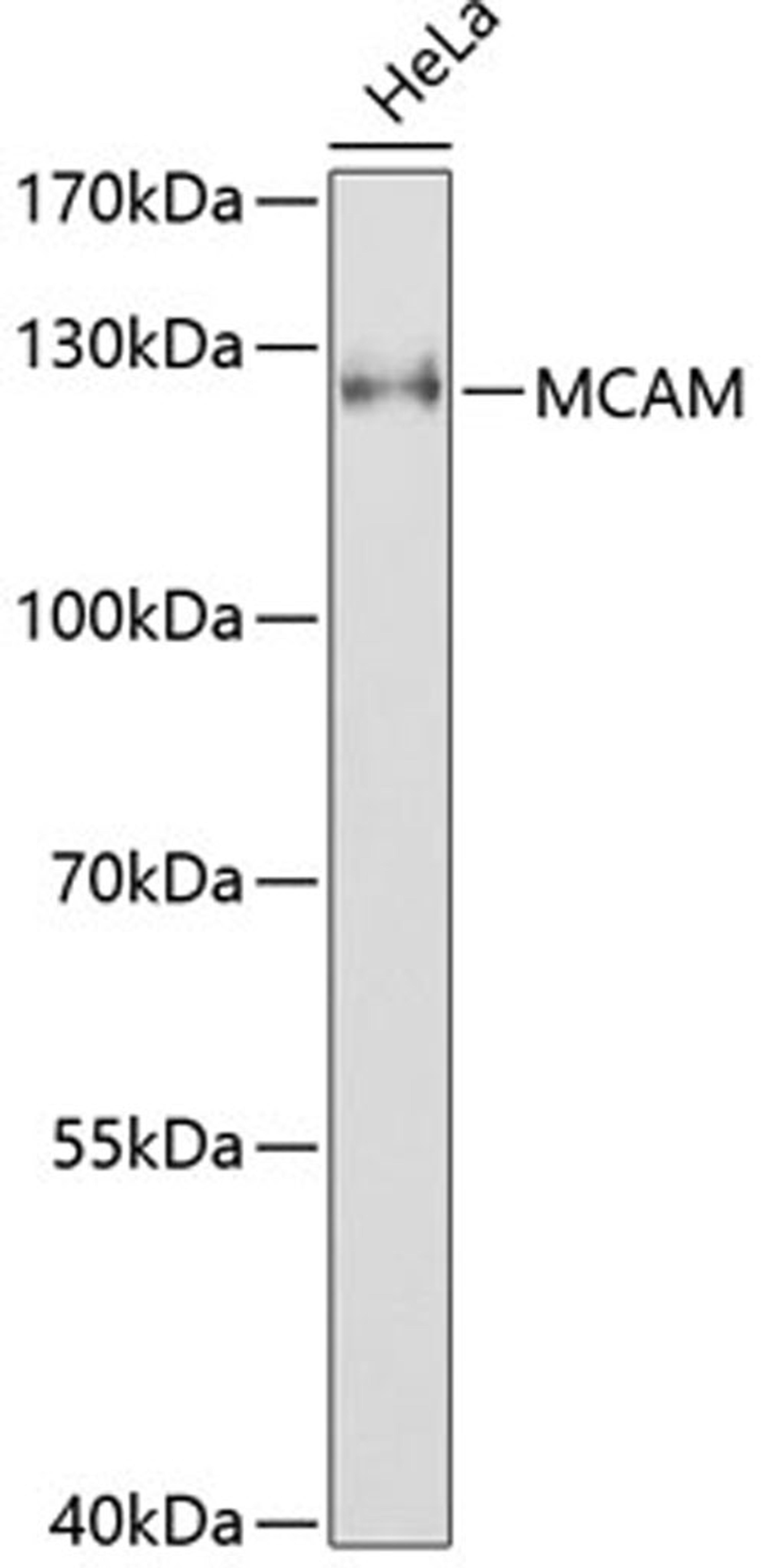 Western blot - MCAM antibody (A1962)