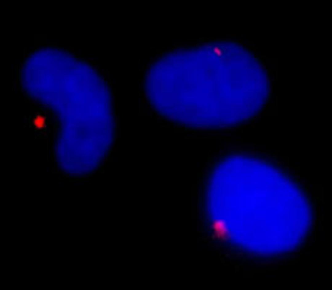 Detection of human Pericentrin/Kendrin by immunocytochemistry.