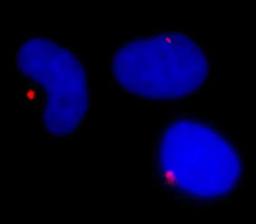 Detection of human Pericentrin/Kendrin by immunocytochemistry.