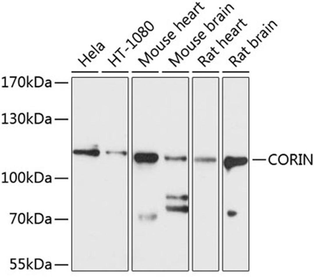 Western blot - CORIN antibody (A10404)