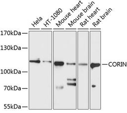 Western blot - CORIN antibody (A10404)