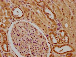 IHC image of CSB-PA010429PA59nme1HU diluted at 1:20 and staining in paraffin-embedded human kidney tissue performed on a Leica BondTM system. After dewaxing and hydration, antigen retrieval was mediated by high pressure in a citrate buffer (pH 6.0). Section was blocked with 10% normal goat serum 30min at RT. Then primary antibody (1% BSA) was incubated at 4°C overnight. The primary is detected by a biotinylated secondary antibody and visualized using an HRP conjugated SP system.