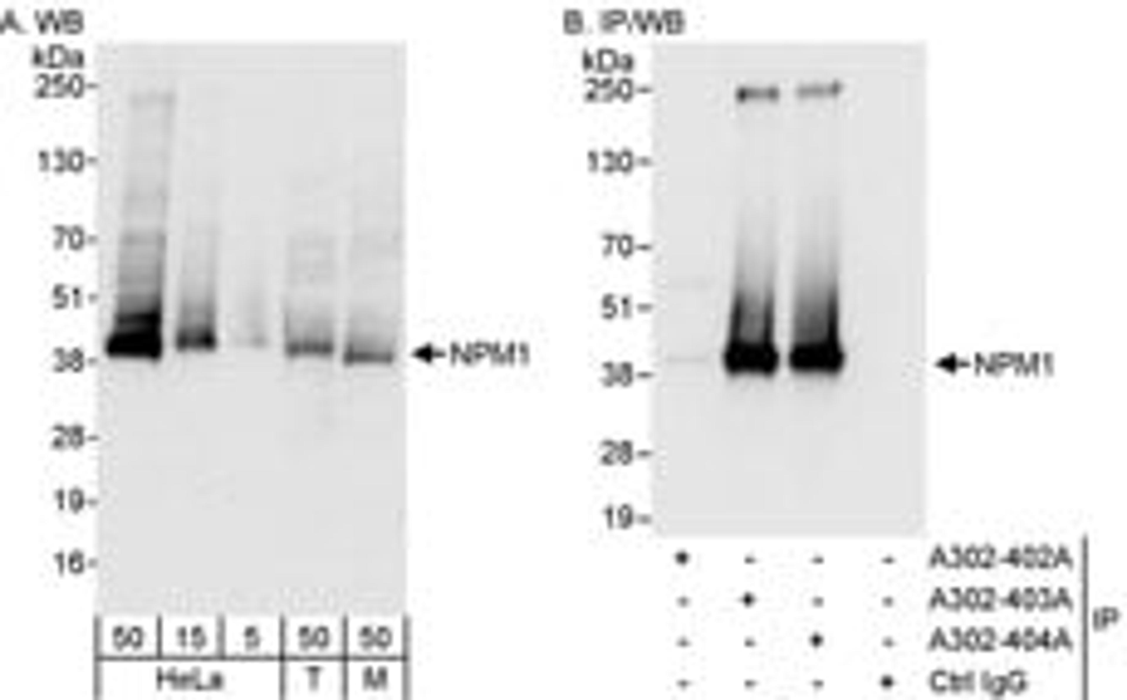 Detection of human and mouse NPM1 by western blot (h & m) and immunoprecipitation (h).