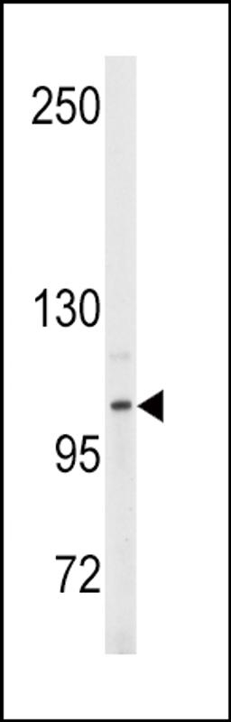 Western blot analysis of anti- in Y79 cell line lysates (35ug/lane).