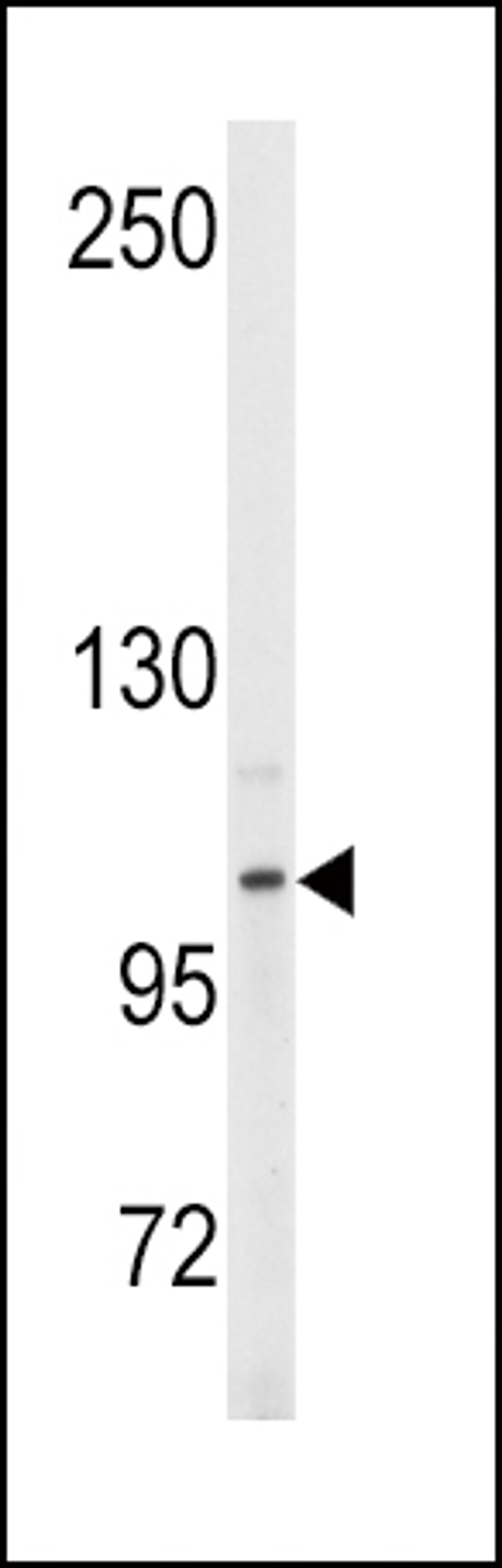 Western blot analysis of anti- in Y79 cell line lysates (35ug/lane).