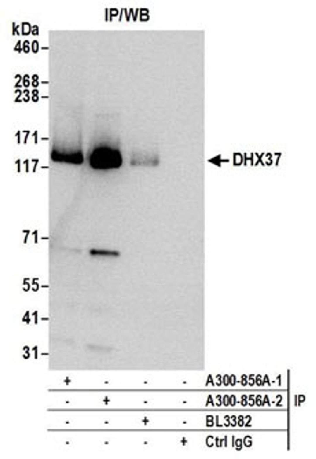 Detection of human DHX37 by western blot of immunoprecipitates.