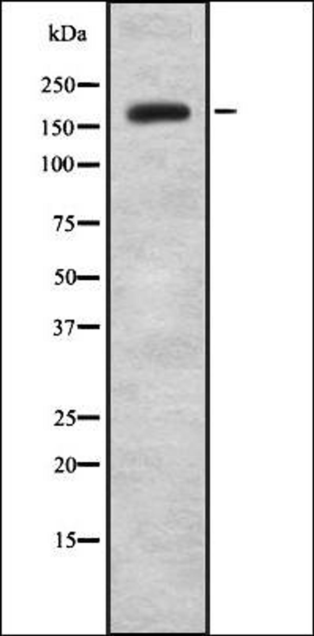 Western blot analysis of HEK293 cells using JAD1B antibody