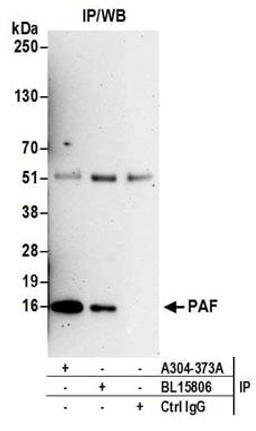 Detection of human PAF by western blot of immunoprecipitates.