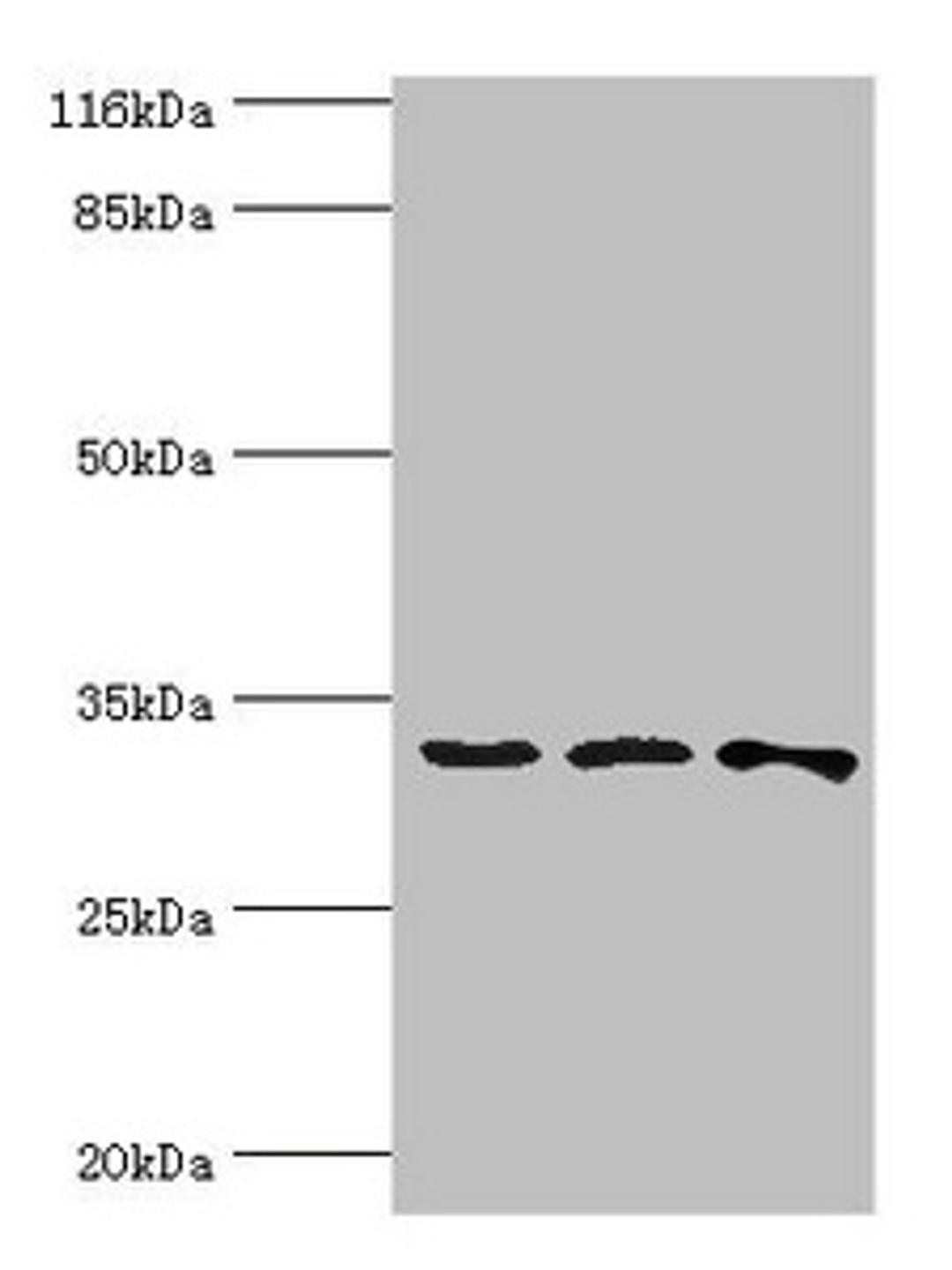 Western blot. All lanes: STARD10 antibody at 2ug/ml. Lane 1: 293T whole cell lysate. Lane 2: k562 whole cell lysate. Lane 3: Mouse heart tissue. Secondary. Goat polyclonal to rabbit IgG at 1/10000 dilution. Predicted band size: 33 kDa. Observed band size: 33 kDa. 