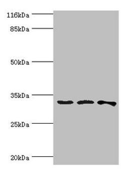 Western blot. All lanes: STARD10 antibody at 2ug/ml. Lane 1: 293T whole cell lysate. Lane 2: k562 whole cell lysate. Lane 3: Mouse heart tissue. Secondary. Goat polyclonal to rabbit IgG at 1/10000 dilution. Predicted band size: 33 kDa. Observed band size: 33 kDa. 