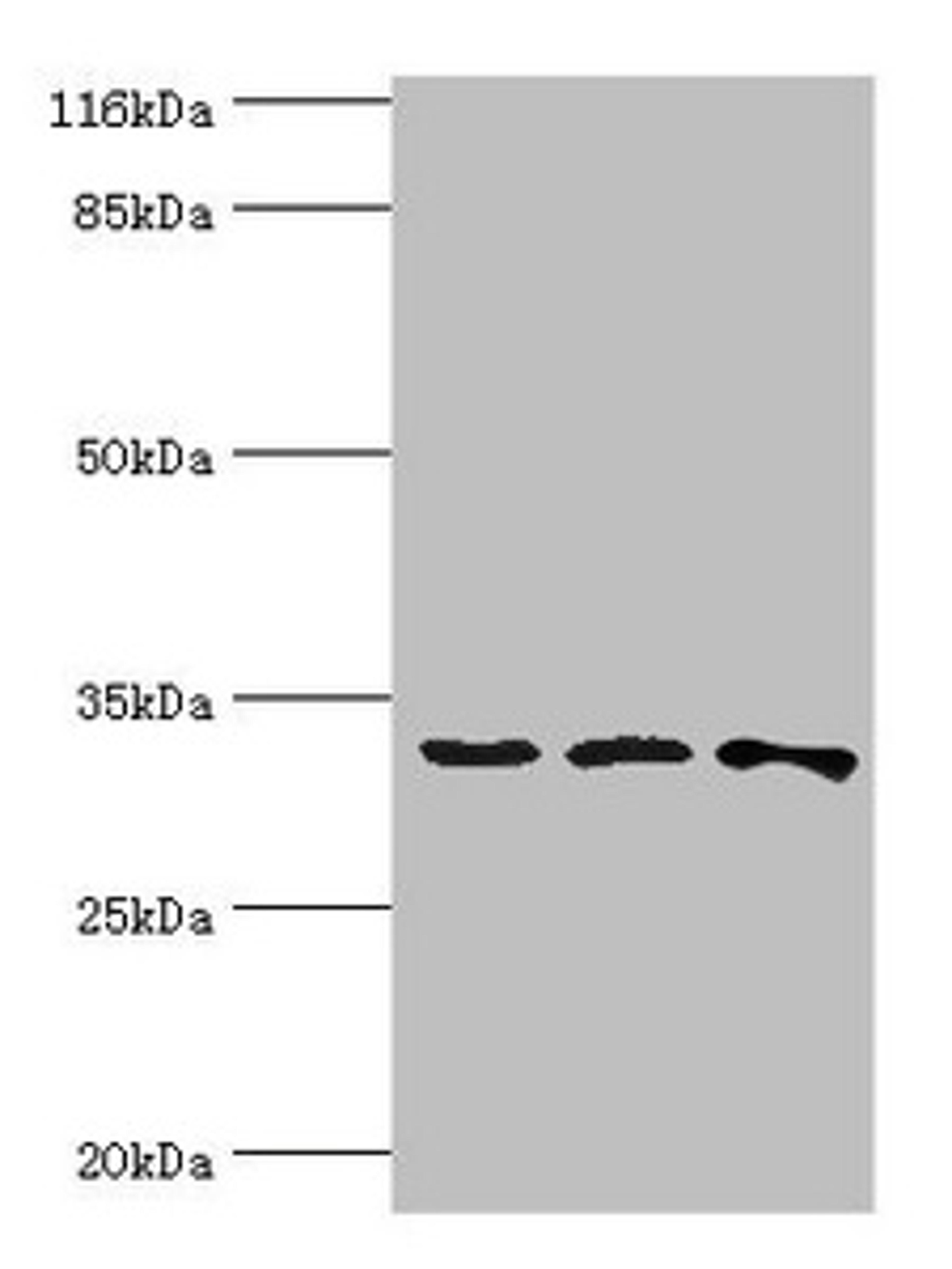 Western blot. All lanes: STARD10 antibody at 2ug/ml. Lane 1: 293T whole cell lysate. Lane 2: k562 whole cell lysate. Lane 3: Mouse heart tissue. Secondary. Goat polyclonal to rabbit IgG at 1/10000 dilution. Predicted band size: 33 kDa. Observed band size: 33 kDa. 