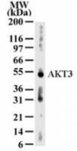 Western Blot: AKT3 Antibody (66C1247) [NB600-1298] - Analysis for AKT3 using NB600-1298 at 2 ug/ml dilution against 30 ug/lane of human kidney lysate.