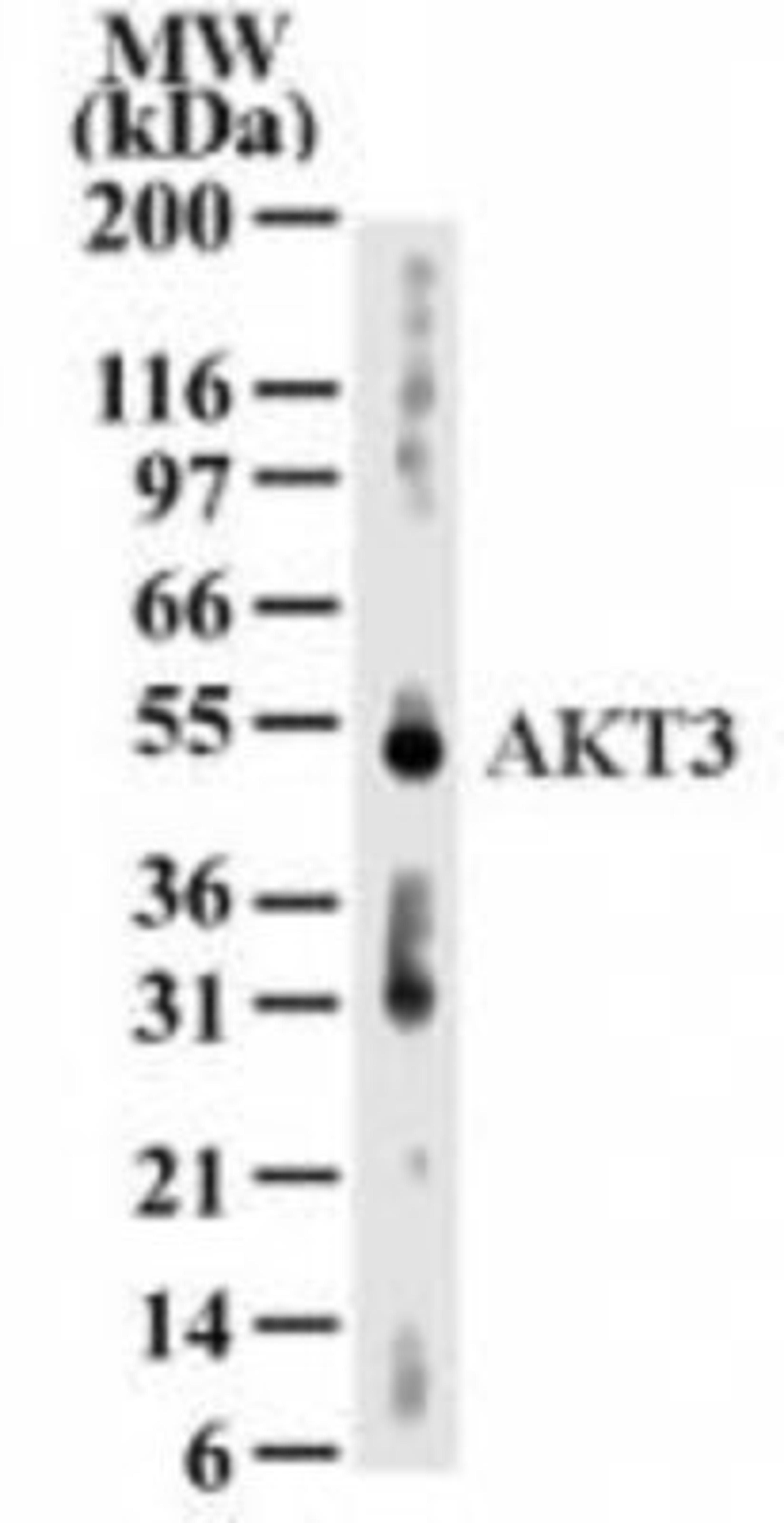 Western Blot: AKT3 Antibody (66C1247) [NB600-1298] - Analysis for AKT3 using NB600-1298 at 2 ug/ml dilution against 30 ug/lane of human kidney lysate.